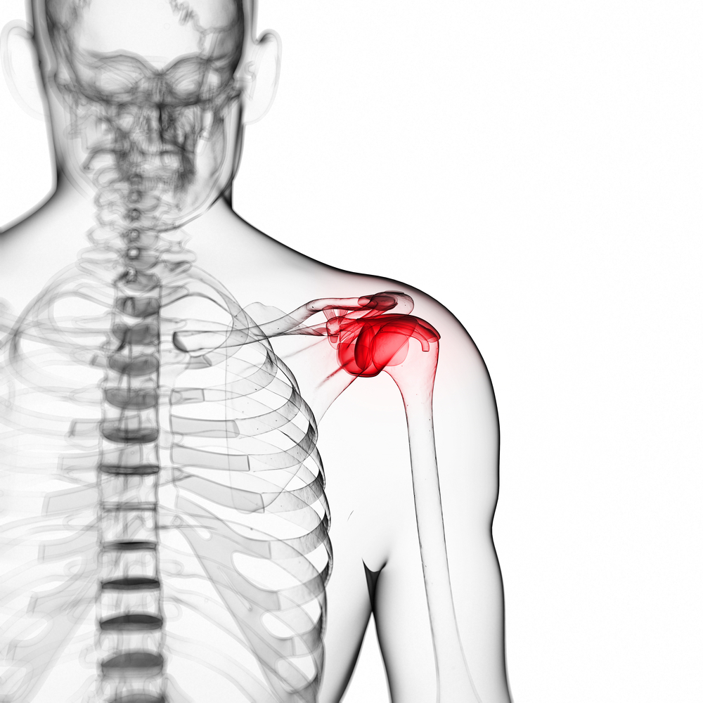 Rotator Cuff