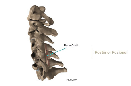 Neck 23