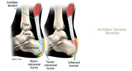 Tiu ankle weights online