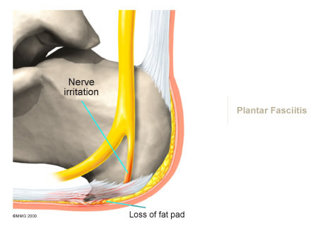 Foot 4